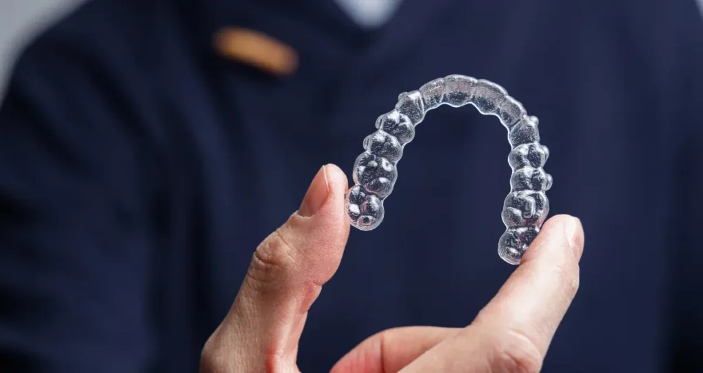 Aligners are the optimal choice