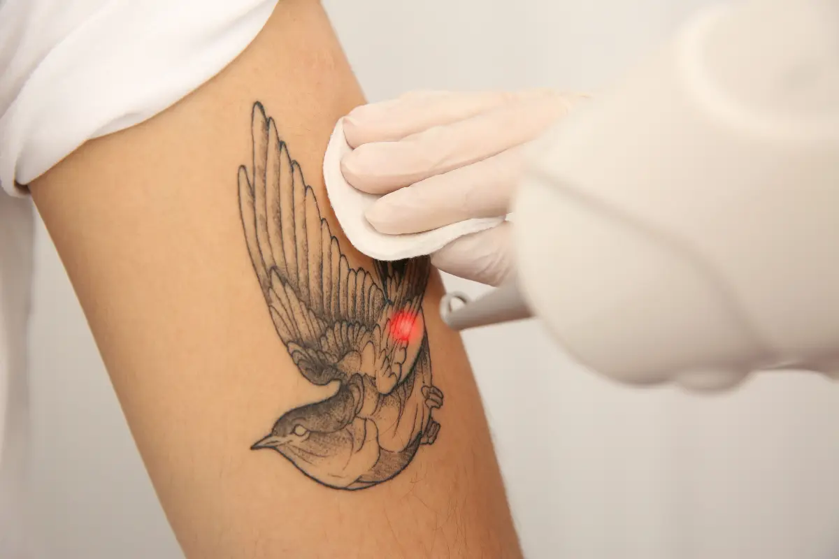 How to Choose the Best Tattoo Removal Clinic Near You