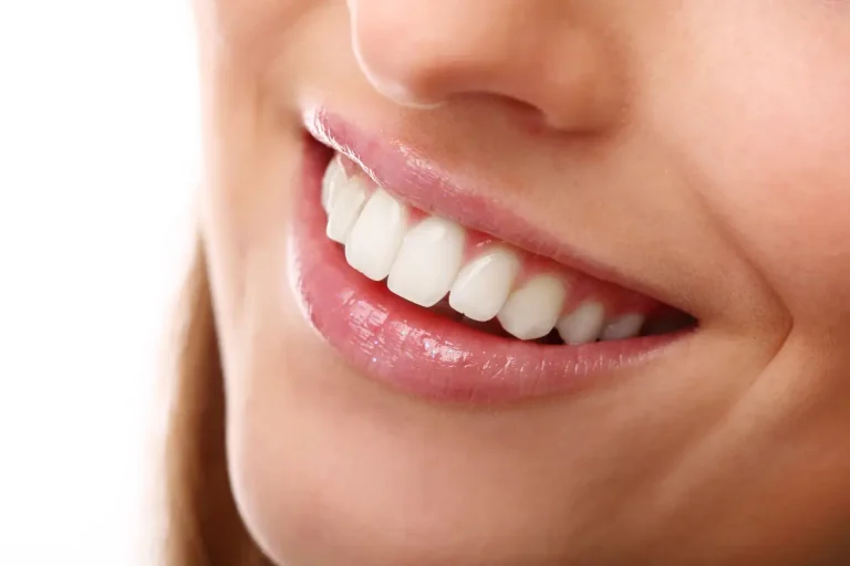 Revolutionizing Teeth Whitening The Ultimate Alternative to Chip WhiteSpeed for Philips Zoom