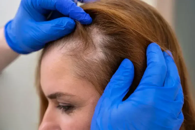 Doctor examining woman's thinning hair